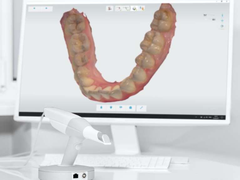 Digital dental scan on computer screen
